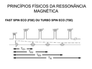 PRINCÍPIOS FÍSICOS DA RESSONÂNCIA
MAGNÉTICA
FAST SPIN ECO (FSE) OU TURBO SPIN ECO (TSE)
 