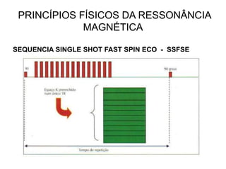 PRINCÍPIOS FÍSICOS DA RESSONÂNCIA
MAGNÉTICA
SEQUENCIA SINGLE SHOT FAST SPIN ECO - SSFSE
 