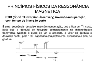 PRINCÍPIOS FÍSICOS DA RESSONÂNCIA
MAGNÉTICA
STIR (Short TI Inversion- Recovery) inversão-recuperação
com tempo de inversão curto
É uma sequência de pulso inversão-recuperação, que utiliza um TI curto,
para que a gordura se recupere completamente na magnetização
transversa. Quando o pulso de 90 é aplicado, o vetor da gordura é
desviado de 90 para 180 , saturando completamente, eliminando o sinal de
gordura.
 