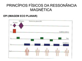 PRINCÍPIOS FÍSICOS DA RESSONÂNCIA
MAGNÉTICA
EPI (IMAGEM ECO PLANAR)
 