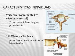CARACTERÍSTICAS INDIVIDUAIS

   Vértebra Proeminente (7ª
    vértebra cervical)
       Processo espinhoso longo e
        proeminente.



   12ª Vértebra Torácica
       processos articulares inferiores
        lateralizados
 