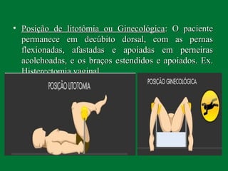 • Posição de litotômia ou GinecológicaPosição de litotômia ou Ginecológica: O paciente: O paciente
permanece em decúbito dorsal, com as pernaspermanece em decúbito dorsal, com as pernas
flexionadas, afastadas e apoiadas em perneirasflexionadas, afastadas e apoiadas em perneiras
acolchoadas, e os braços estendidos e apoiados. Ex.acolchoadas, e os braços estendidos e apoiados. Ex.
Histerectomia vaginal.Histerectomia vaginal.
 