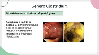Gênero Clostridium
Clostrídios enterotóxicos - C. perfringens
Patogênese e padrão da
doença: C. perfringens causa
doença intestinal grave,
inclusive enterotoxemia
importante, e infecções
histotóxicas.
 