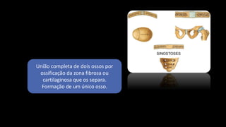 União completa de dois ossos por
ossificação da zona fibrosa ou
cartilaginosa que os separa.
Formação de um único osso.
 