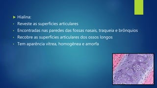  Hialina:
• Reveste as superfícies articulares
• Encontradas nas paredes das fossas nasais, traqueia e brônquios
• Recobre as superfícies articulares dos ossos longos
• Tem aparência vítrea, homogênea e amorfa
 
