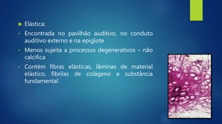  Elástica:
• Encontrada no pavilhão auditivo, no conduto
auditivo externo e na epiglote
• Menos sujeita a processos degenerativos – não
calcifica
• Contém fibras elásticas, lâminas de material
elástico, fibrilas de colágeno e substância
fundamental
 