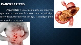 PANCREATITES
Pancreatite é uma inflamação do pâncreas
que tem o consumo de álcool como o principal
fator desencadeador da doença. A condição pode
ser crônica ou aguda.
 