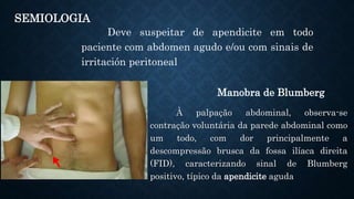 Deve suspeitar de apendicite em todo
paciente com abdomen agudo e/ou com sinais de
irritación peritoneal
Manobra de Blumberg
À palpação abdominal, observa-se
contração voluntária da parede abdominal como
um todo, com dor principalmente a
descompressão brusca da fossa ilíaca direita
(FID), caracterizando sinal de Blumberg
positivo, típico da apendicite aguda
SEMIOLOGIA
 