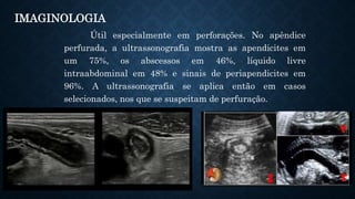 Útil especialmente em perforações. No apêndice
perfurada, a ultrassonografia mostra as apendicites em
um 75%, os abscessos em 46%, líquido livre
intraabdominal em 48% e sinais de periapendicites em
96%. A ultrassonografia se aplica então em casos
selecionados, nos que se suspeitam de perfuração.
IMAGINOLOGIA
 
