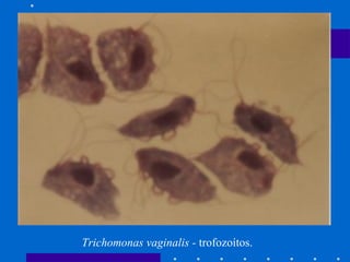 Trichomonas vaginalis -  trofozoítos.  