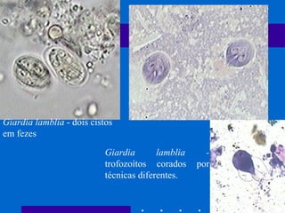 Giardia lamblia  - dois cistos em fezes     Giardia lamblia -  trofozoítos corados por técnicas diferentes. 