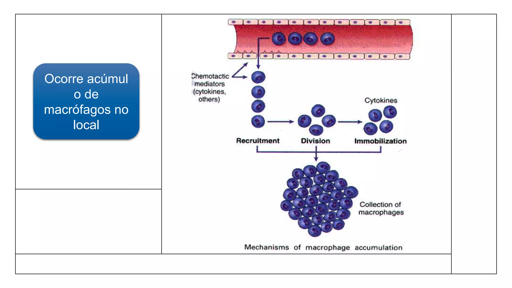 Ocorre acúmul
o de
macrófagos no
local
 