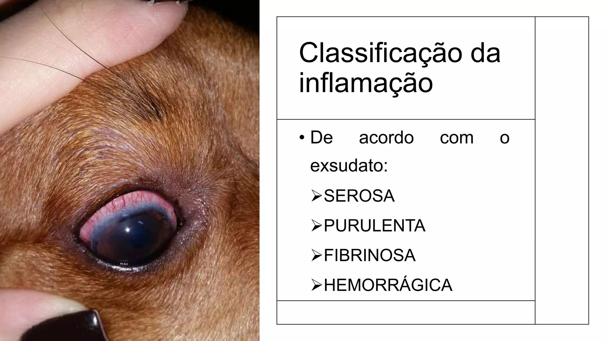 Classificação da
inflamação
• De acordo com o
exsudato:
SEROSA
PURULENTA
FIBRINOSA
HEMORRÁGICA
 