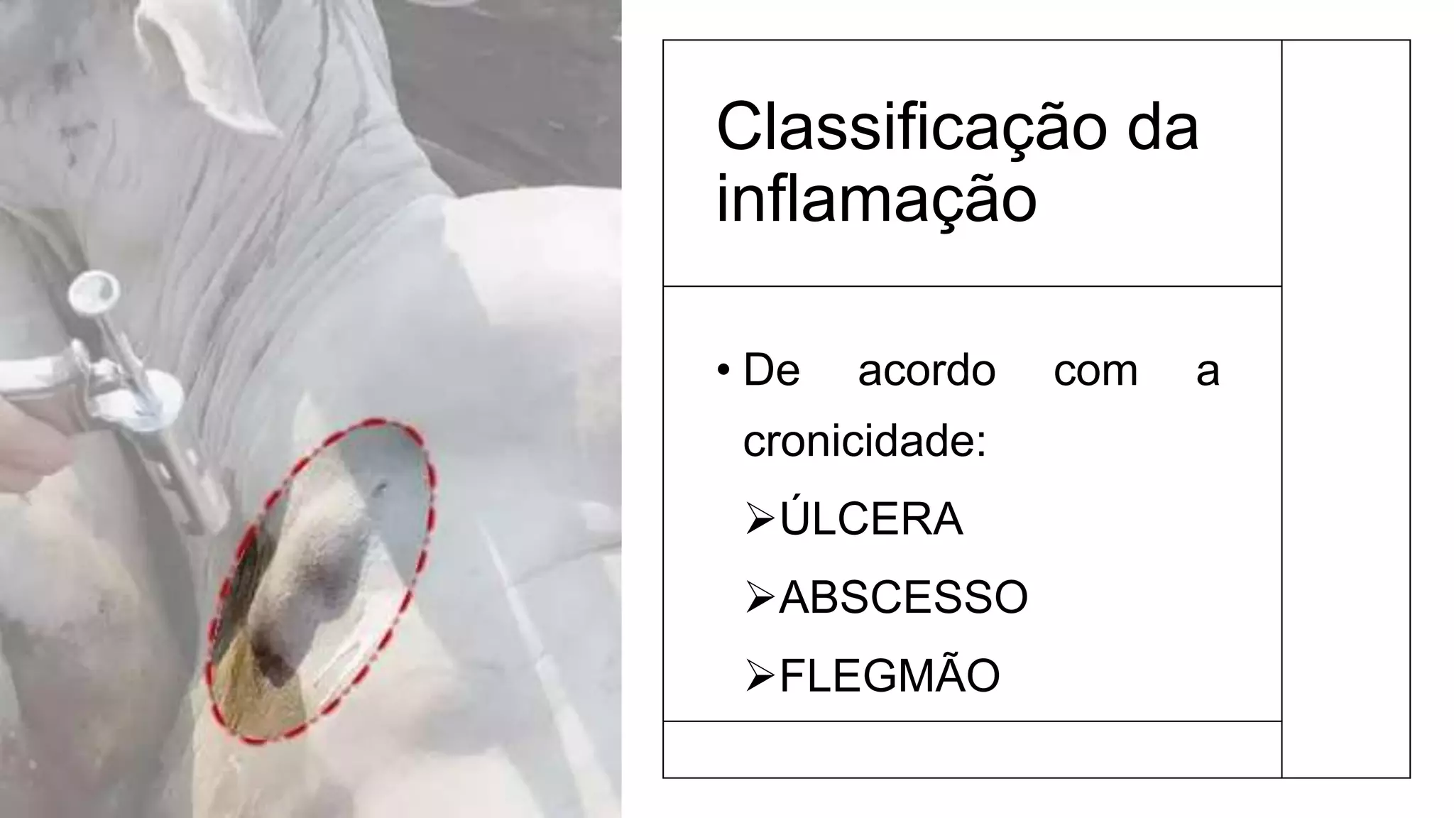 Classificação da
inflamação
• De acordo com a
cronicidade:
ÚLCERA
ABSCESSO
FLEGMÃO
 