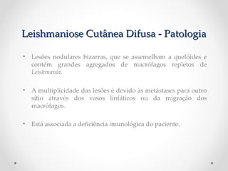 Leishmaniose Cutânea Difusa - PatologiaLeishmaniose Cutânea Difusa - Patologia
• Lesões nodulares bizarras, que se assemelham a quelóides e
contém grandes agregados de macrófagos repletos de
Leishmania.
• A multiplicidade das lesões é devido às metástases para outro
sítio através dos vasos linfáticos ou da migração dos
macrófagos.
• Está associada a defciência imunológica do paciente.
nao chegam na derme
está relacionada com promastigota e amastigota
está associada a imunidade
 