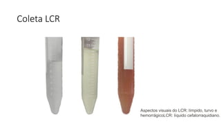 aula 3 - Líquido cefalorraquidiano (LCR).pptx