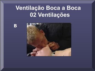 Ventilação Boca a Boca
02 Ventilações
 