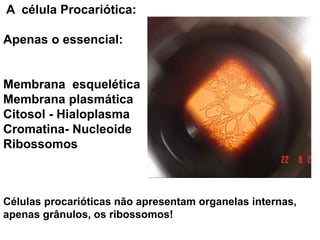 A célula Procariótica:
Apenas o essencial:
Membrana esquelética
Membrana plasmática
Citosol - Hialoplasma
Cromatina- Nucleoide
Ribossomos
Aumento: 1000X
Células procarióticas não apresentam organelas internas,
apenas grânulos, os ribossomos!
 