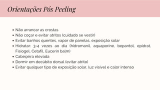 Orientações Pós Peeling
Não arrancar as crostas
Não coçar e evitar atritos (cuidado se vestir)
Evitar banhos quentes, vapor de panelas, exposição solar
Hidratar: 3-4 vezes ao dia (hidromanil, aquaporine, bepantol, epidrat,
Fisiogel, Cetafil, Eucerin balm)
Cabeçeira elevada
Dormir em decúbito dorsal (evitar atrito)
Evitar qualquer tipo de exposição solar, luz visível e calor intenso
 