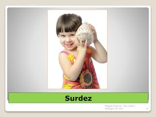 Surdez
Magda Charrua 2011/2012
Biologia 12º ano 12
 