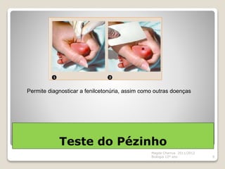 Teste do Pézinho
Magda Charrua 2011/2012
Biologia 12º ano 9
Permite diagnosticar a fenilcetonúria, assim como outras doenças
 