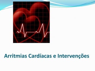 Arritmias Cardíacas e Intervenções

 