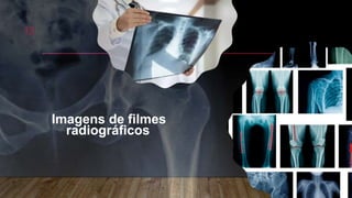 Imagens de filmes
radiográficos.
13
 