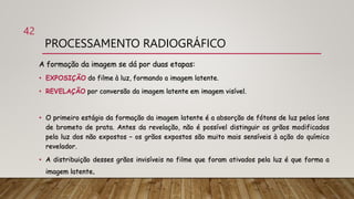 PROCESSAMENTO RADIOGRÁFICO
A formação da imagem se dá por duas etapas:
• EXPOSIÇÃO do filme à luz, formando a imagem latente.
• REVELAÇÃO por conversão da imagem latente em imagem visível.
• O primeiro estágio da formação da imagem latente é a absorção de fótons de luz pelos íons
de brometo de prata. Antes da revelação, não é possível distinguir os grãos modificados
pela luz dos não expostos – os grãos expostos são muito mais sensíveis à ação do químico
revelador.
• A distribuição desses grãos invisíveis no filme que foram ativados pela luz é que forma a
imagem latente.
42
 