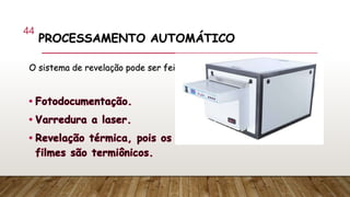 PROCESSAMENTO AUTOMÁTICO
O sistema de revelação pode ser feito por:
44
 