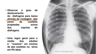 • Observar o grau de
deslocamento
do diafragma para baixo
através da contagem dos
pares de costelas
projetadas acima
das cúpulas do
diafragma.
• Uma regra geral para a
média dos adultos
é “mostrar” um mínimo
de dez costelas no tórax
em PA ideal.
PROF. FERNANDA LIMA
 