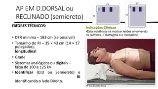 PROF. FERNANDA LIMA
FATORES TÉCNICOS:
• DFR mínima − 183 cm (se possível)
• Tamanho do RI – 35 × 43 cm (14 × 17
polegadas),
longitudinal
• Grade
• Sistemas analógicos ou digitais –
faixa de 100 a 125 kV
• Identificar (D.D ou Semiereto) e
RI
identificando o lado Direito.
Indicações Clínicas
•Esta incidência irá mostrar lesões envolvendo
os pulmões, o diafragma e o mediastino.
AP EM D.DORSAL ou
RECLINADO (semiereto)
 