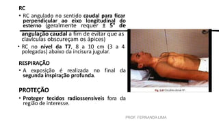 PROF. FERNANDA LIMA
RC
• RC angulado no sentido caudal para ficar
perpendicular ao eixo longitudinal do
esterno (geralmente requer ± 5° de
angulação caudal a fim de evitar que as
clavículas obscureçam os ápices)
• RC no nível da T7, 8 a 10 cm (3 a 4
polegadas) abaixo da incisura jugular.
RESPIRAÇÃO
• A exposição é realizada no final da
segunda inspiração profunda.
PROTEÇÃO
• Proteger tecidos radiossensíveis fora da
região de interesse.
 