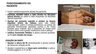 PROF. FERNANDA LIMA
POSICIONAMENTO DO
PACIENTE
• Coxim radiotransparente abaixo do paciente.
• Paciente deitado sobre o lado direito no decúbito
lateral direito ou sobre o lado esquerdo no decúbito
lateral esquerdo.
• Queixo do paciente erguido e ambos os braços
erguidos acima da cabeça para não haver
superposição sobre o campo pulmonar; as costas do
paciente firmemente apoiadas contra o RI; maca
travada para impedir que o paciente se mova para
frente e sofra uma queda; travesseiro sob a cabeça.
• Joelhos levemente fletidos e plano coronal paralelo
ao RI sem rotação do corpo.
POSIÇÃO DA PARTE
• Ajustar a altura do RI centralizando o ponto central
do tórax em relação ao RI.
• Ajustar o paciente e a maca para centralizar o plano
mediossagital e a T7 no RC.
 