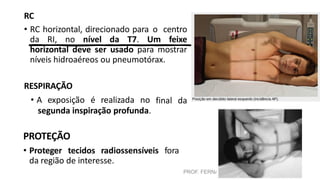 PROF. FERNANDA LIMA
RC
• RC horizontal, direcionado para o centro
da RI, no nível da T7. Um feixe
horizontal deve ser usado para mostrar
níveis hidroaéreos ou pneumotórax.
RESPIRAÇÃO
final da
• A exposição é realizada no
segunda inspiração profunda.
PROTEÇÃO
• Proteger tecidos radiossensíveis fora
da região de interesse.
 