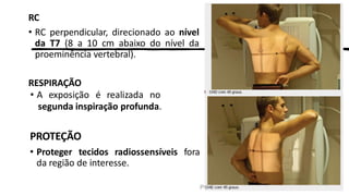 PROF. FERNANDA LIMA
RC
• RC perpendicular, direcionado ao nível
da T7 (8 a 10 cm abaixo do nível da
proeminência vertebral).
RESPIRAÇÃO
• A exposição é realizada no
segunda inspiração profunda.
PROTEÇÃO
• Proteger tecidos radiossensíveis fora
da região de interesse.
 