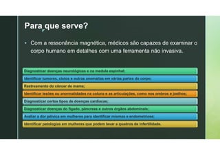 z
Para que serve?
 Com a ressonância magnética, médicos são capazes de examinar o
corpo humano em detalhes com uma ferramenta não invasiva.
Diagnosticar doenças neurológicas e na medula espinhal;
Identificar tumores, cistos e outras anomalias em várias partes do corpo;
Rastreamento do câncer de mama;
Identificar lesões ou anormalidades na coluna e as articulações, como nos ombros e joelhos;
Diagnosticar certos tipos de doenças cardíacas;
Diagnosticar doenças do fígado, pâncreas e outros órgãos abdominais;
Avaliar a dor pélvica em mulheres para identificar miomas e endometriose;
Identificar patologias em mulheres que podem levar a quadros de infertilidade.
 