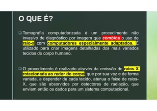 z
O QUE É?
 Tomografia computadorizada é um procedimento não
invasivo de diagnóstico por imagem que combina o uso de
raio-x com computadores especialmente adaptados. É
utilizado para criar imagens detalhadas dos mais variados
tecidos do corpo humano.
 O procedimento é realizado através da emissão de raios X
rotacionada ao redor do corpo, que por sua vez e de forma
variada, a depender de cada tecido, atenua o feixe de raios-
X, que são absorvidos por detectores de radiação, que
enviam então os dados para um sistema computacional.
 