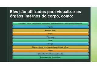 z
Eles são utilizados para visualizar os
órgãos internos do corpo, como:
Coração e vasos sanguíneos, incluindo a aorta abdominal e seus principais ramos;
Fígado;
Vesícula biliar;
Baço;
Pâncreas;
Rins;
Bexiga;
Útero, ovários e, em pacientes grávidas, o feto;
Olhos;
Glândulas tireóide e paratireóide;
Bolsa escrotal (testículos).
 