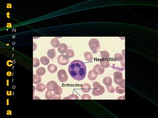 • N
e
u
t
r
ó
f
i
l
o
s
a
t
a
-
C
e
l
u
l
a
 