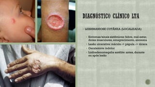 ▪ LEISHMANIOSE CUTÂNEA (LOCALIZADA)
▪ Sintomas/sinais sistêmicos: febre, mal-estar,
dores musculares, emagrecimento, anorexia
▪ Lesão ulcerativa: mácula -> pápula -> úlcera
▪ Geralemnte indolor
▪ Linfoadenomegalia satélite: antes, durante
ou após lesão
 
