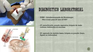 ▪ IDRM – Intradermoreação de Montenegro
▪ Não é bom para LV nem LT/HIV
▪ LT: escarificação,punção aspirativa, biópsia de lesão
cutânea, linfonodos ou mucosas
▪ LV: aspirado de medula óssea, biópsia ou punção (baço,
fígado ou linfonodos)
 