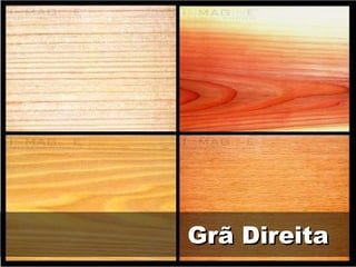 Grã Direita
 
