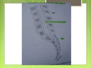 Aula Medula Espinhal