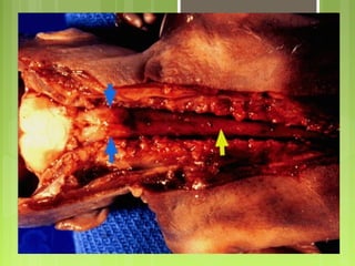 Aula Medula Espinhal
