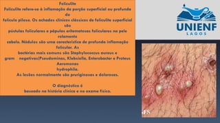 Foliculite
Foliculite refere-se à inflamação da porção superficial ou profunda
do
folículo piloso. Os achados clínicos clássicos de foliculite superficial
são
pústulas foliculares e pápulas eritematosas foliculares na pele
rolamento
cabelo. Nódulos são uma característica de profunda inflamação
folicular. As
bactérias mais comuns são Staphylococcus aureus e
gram negativas(Pseudominas, Klebsiella, Enterobacter e Proteus
Aeromonas
hydrophila.
As lesões normalmente são pruriginosas e dolorosas.
O diagnóstico é
baseado na história clínica e no exame físico.
 
