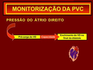 PRESSÃO DO ÁTRIO DIREITO
MONITORIZAÇÃO DA PVC
Pré-carga do VD
Enchimento do VD no
final da diástole
Capacidade
 