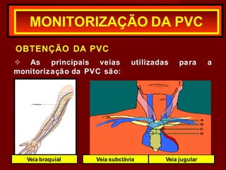 MONITORIZAÇÃO DA PVC
utilizadas para a
OBTENÇÃO DA PVC
❖ As principais veias
monitorização da PVC são:
Veia braquial Veia subclávia Veia jugular
 