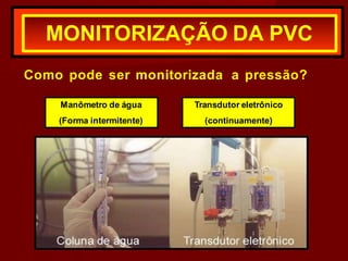Como pode ser monitorizada a pressão?
MONITORIZAÇÃO DA PVC
Transdutor eletrônico
(continuamente)
Manômetro de água
(Forma intermitente)
 