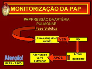 MONITORIZAÇÃO DA PAP
PAPPRESSÃO DAARTÉRIA
PULMONAR
Fase Sistólica
Fluxo sanguíneo
rápido
VD
VEM
Artéria
pulmonar
Aberturada
valva
pulmonar
APÓS
PAPS = PSVD
 