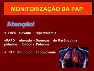 MONITORIZAÇÃO DA PAP
♦ PAPS elevada - Hipervolemia
♦PAPD elevado - Doenças do Parênquima
pulmonar, Embolia Pulmonar
♦ PAP diminuído - Hipovolemia
 